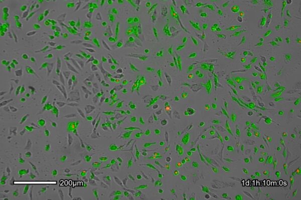 Image_TEC_INS_CytoSMART_FL_02_1000x665_JPG Image_TEC_INS_CytoSMART_FL_02_1000x665_JPG